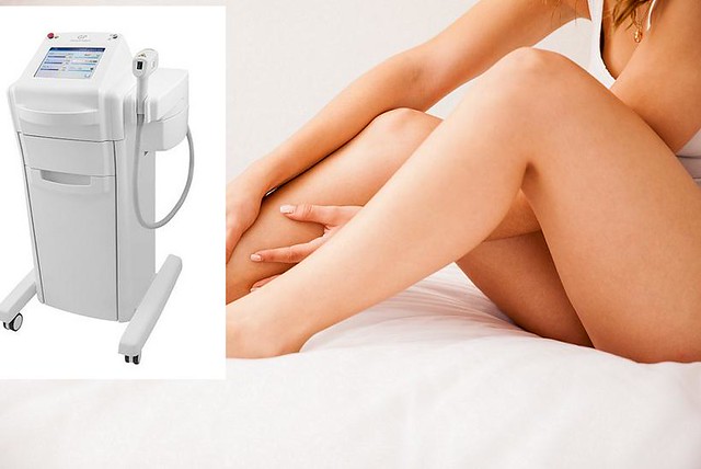 Title: The Beauty of Diode Laser Hair Removal Machine